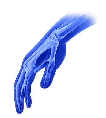 Hand & Wrist Fixations