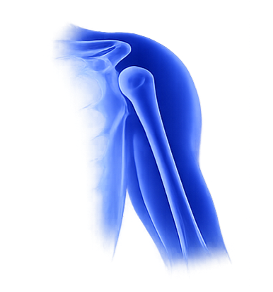 Shoulder Trauma Solutions